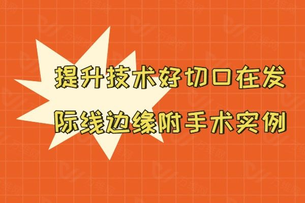 杨大平拉皮提升好吗www.01www.com